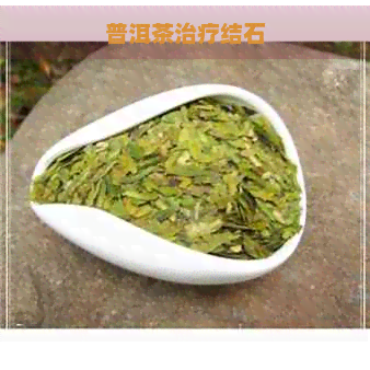 普洱茶治疗结石