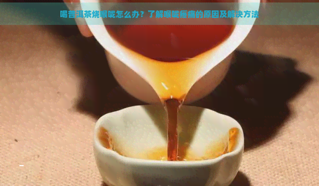 喝普洱茶烧喉咙怎么办？了解喉咙疼痛的原因及解决方法