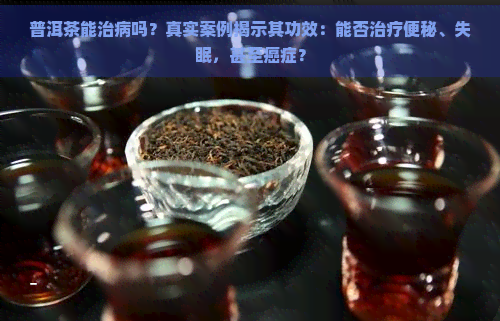 普洱茶能治病吗？真实案例揭示其功效：能否治疗便秘、失眠，甚至癌症？