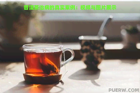 普洱茶治病的真实案例：视频与图片展示