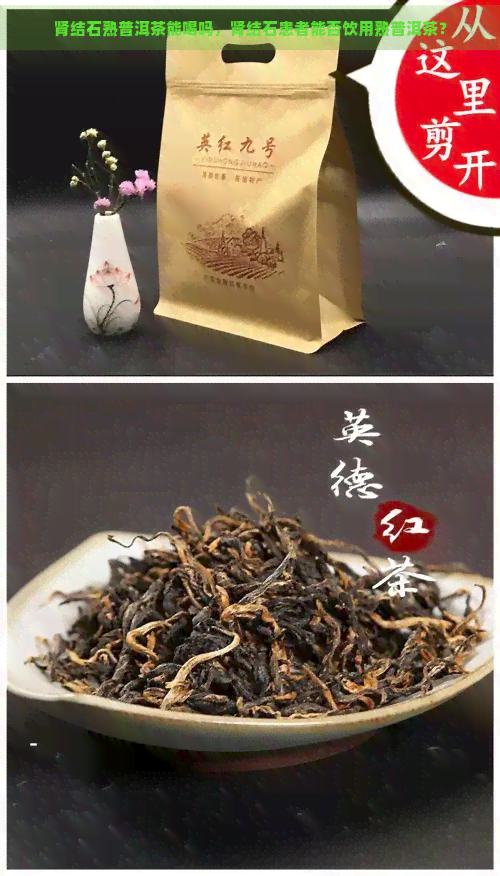 肾结石熟普洱茶能喝吗，肾结石患者能否饮用熟普洱茶？