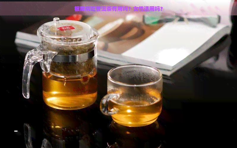 银屑病吃普洱茶有用吗？女性适用吗？